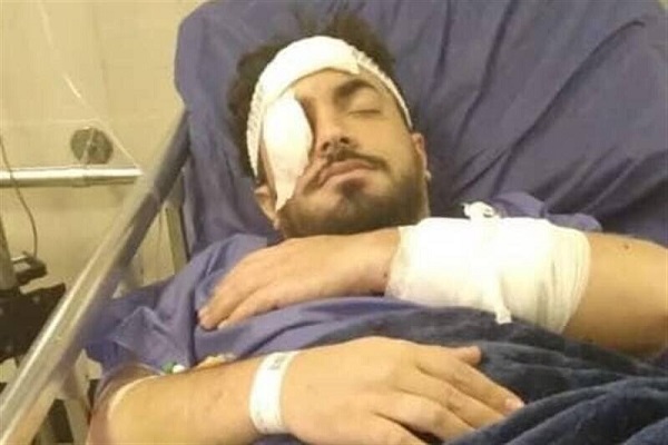 عکس | حمله به یک روحانی در تهرانپارس؛ انتقال به بیمارستان | ورزش صبحگاهی تبدیل به حمام خون شد