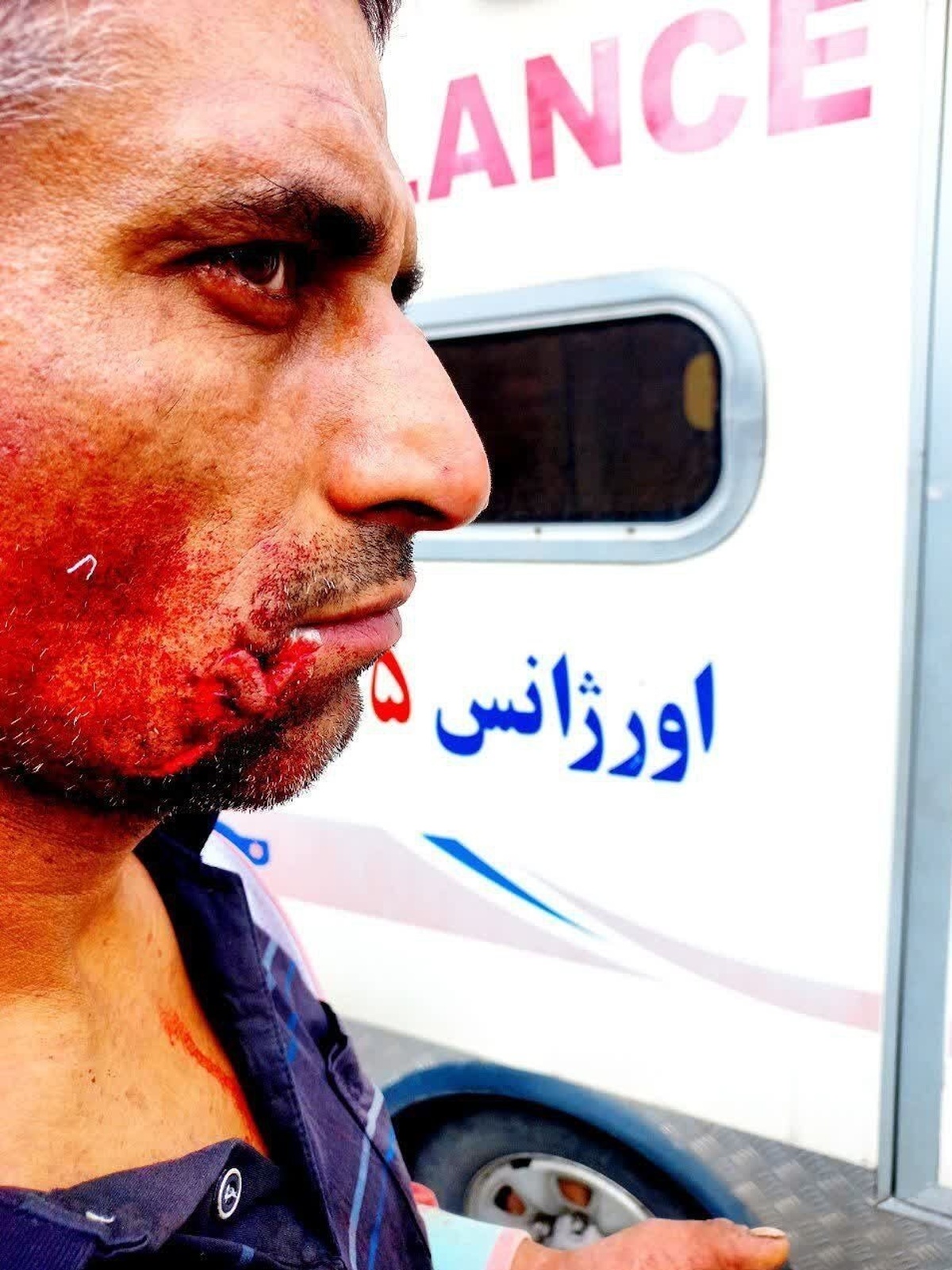 مجروح شدن کارگر شهرداری فردیس بر اثرحمله سگ